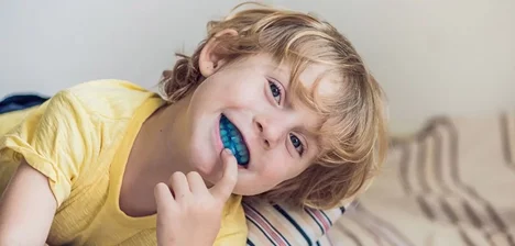 دندان قروچه یا براکسیسم در کودکان