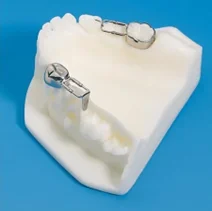 فضانگهدارنده دندان کودکان